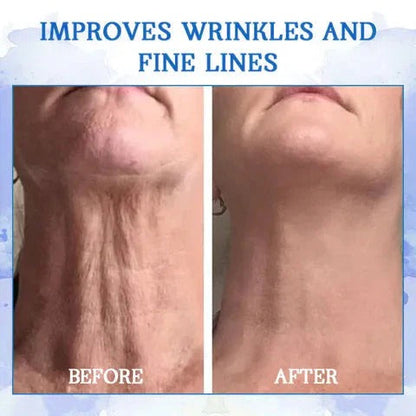 Fubsta™ Advanced Skin Tightening Rejuvenating Cream  ( BUY 1 GET 1 FREE )⭐️⭐️⭐️⭐️ 4.9/5 Reviews