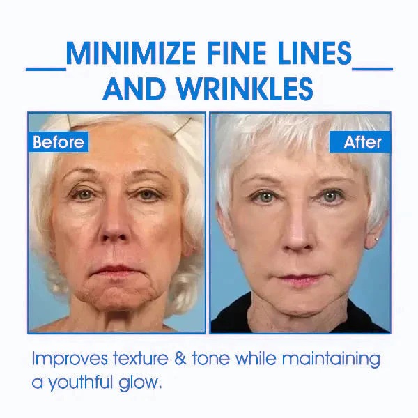 Fubsta™ Advanced Skin Tightening Rejuvenating Cream  ( BUY 1 GET 1 FREE )⭐️⭐️⭐️⭐️ 4.9/5 Reviews