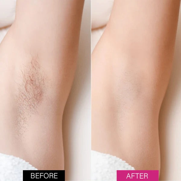 Fivfivgo™ BeeSilk Hair Removal Mousse-BUY 1 GET 1 FREE ⭐️⭐️⭐️⭐️ 4.9/5 Reviews