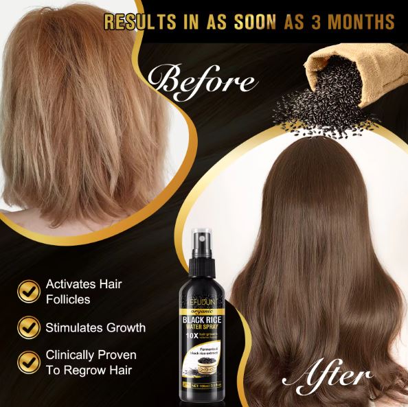 SEFUDUN Organic Black Rice Water for Hair Growth Spray- BUY 1 GET 1 FREE