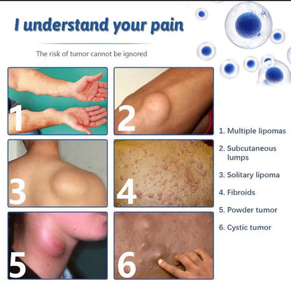 LipoCare™ | Doctor's No 1 choice | Lipoma Removal Cream 🩺- ( BUY 1 GET 1 FREE )⭐️⭐️⭐️⭐️ 4.9/5 Reviews